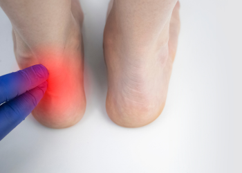 Tendonitis