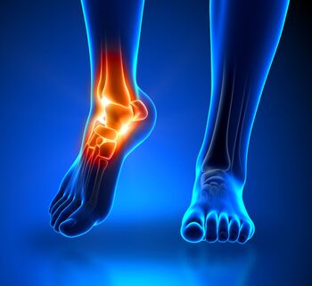 Ankle Pain X-Ray