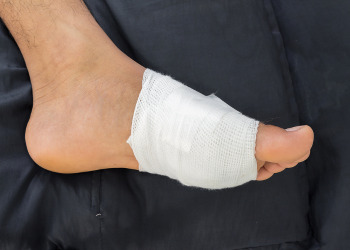 Foot Cosmetic Procedure in NYC
